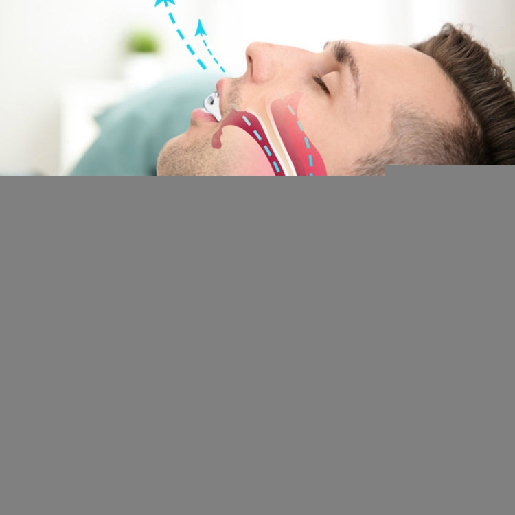 YJK100 Silicone + ABS Stop Snoring Device Anti Snore